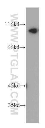 INVS Antibody in Western Blot (WB)