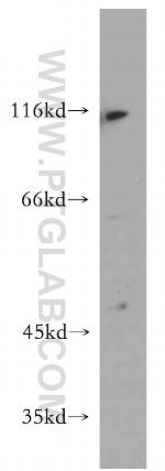 INVS Antibody in Western Blot (WB)