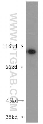 INVS Antibody in Western Blot (WB)