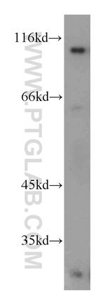 INVS Antibody in Western Blot (WB)