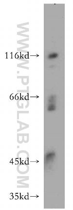 INVS Antibody in Western Blot (WB)