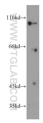 INVS Antibody in Western Blot (WB)