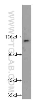 INVS Antibody in Western Blot (WB)