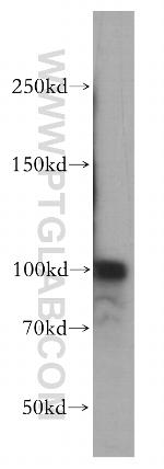 RBM15 Antibody in Western Blot (WB)