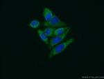 EXTL3 Antibody in Immunocytochemistry (ICC/IF)