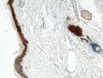 Cytokeratin 6A Antibody in Immunohistochemistry (Paraffin) (IHC (P))