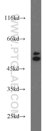 Cytokeratin 6A Antibody in Western Blot (WB)