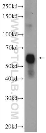 Cytokeratin 6A Antibody in Western Blot (WB)