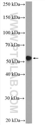 Cytokeratin 6A Antibody in Western Blot (WB)