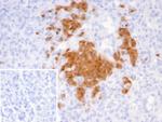 SCGN/Secretagogin Monoclonal Antibody (SCGN/7321)