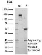 SCGN/Secretagogin Antibody in SDS-PAGE (SDS-PAGE)