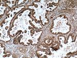APOBEC3C Antibody in Immunohistochemistry (Paraffin) (IHC (P))