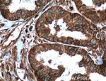 APOBEC3C Antibody in Immunohistochemistry (Paraffin) (IHC (P))