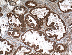APOBEC3C Antibody in Immunohistochemistry (Paraffin) (IHC (P))