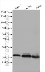 APOBEC3C Antibody in Western Blot (WB)