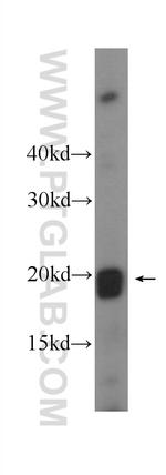 APOBEC3C Antibody in Western Blot (WB)