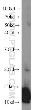 APOBEC3C Antibody in Western Blot (WB)