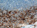 CD138/Syndecan-1 Antibody in Immunohistochemistry (Paraffin) (IHC (P))