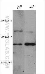 CD138/Syndecan-1 Antibody in Western Blot (WB)