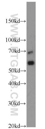 CD138/Syndecan-1 Antibody in Western Blot (WB)