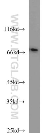 CD24 Antibody in Western Blot (WB)