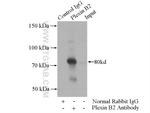 Plexin B2 Antibody in Immunoprecipitation (IP)