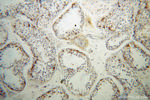 IFT81 Antibody in Immunohistochemistry (Paraffin) (IHC (P))