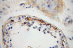 IFT81 Antibody in Immunohistochemistry (Paraffin) (IHC (P))
