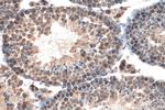 IFT81 Antibody in Immunohistochemistry (Paraffin) (IHC (P))