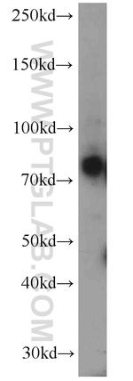 IFT81 Antibody in Western Blot (WB)