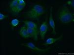 APOBEC3G Antibody in Immunocytochemistry (ICC/IF)