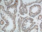 APOBEC3G Antibody in Immunohistochemistry (Paraffin) (IHC (P))