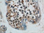 APOBEC3G Antibody in Immunohistochemistry (Paraffin) (IHC (P))