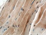 CHRNA1 Antibody in Immunohistochemistry (Paraffin) (IHC (P))