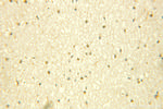 PKNOX1 Antibody in Immunohistochemistry (Paraffin) (IHC (P))