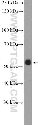 PKNOX1 Antibody in Western Blot (WB)