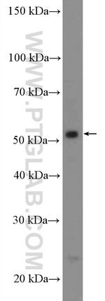 PKNOX1 Antibody in Western Blot (WB)