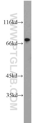 RORA Antibody in Western Blot (WB)