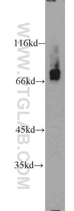 RORA Antibody in Western Blot (WB)