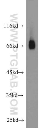 RORA Antibody in Western Blot (WB)