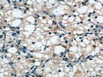 SDHB Antibody in Immunohistochemistry (Paraffin) (IHC (P))
