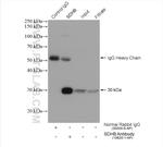 SDHB Antibody in Immunoprecipitation (IP)
