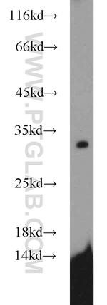SDHB Antibody in Western Blot (WB)