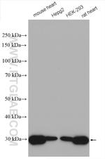 SDHB Antibody in Western Blot (WB)