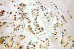 FUBP3 Antibody in Immunohistochemistry (Paraffin) (IHC (P))