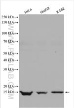 GEMIN7 Antibody in Western Blot (WB)