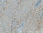 FBXO44 Antibody in Immunohistochemistry (Paraffin) (IHC (P))