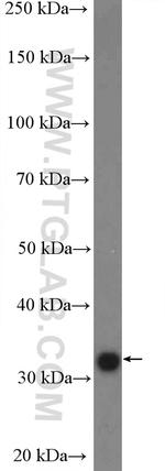 FBXO44 Antibody in Western Blot (WB)
