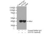 EEF1D Antibody in Immunoprecipitation (IP)