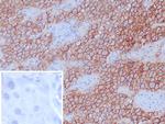 Podoplanin (PDPN) (Lymphatic Endothelial and Mesothelial Marker) Monoclonal Antibody (D2-40)